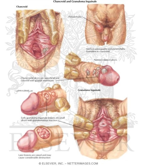 Bacterial infections - Wellness